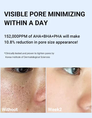 Medicube Zero Pore One Day Serum 30ml